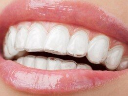 dentista nemesini Nadia dentista nemesini